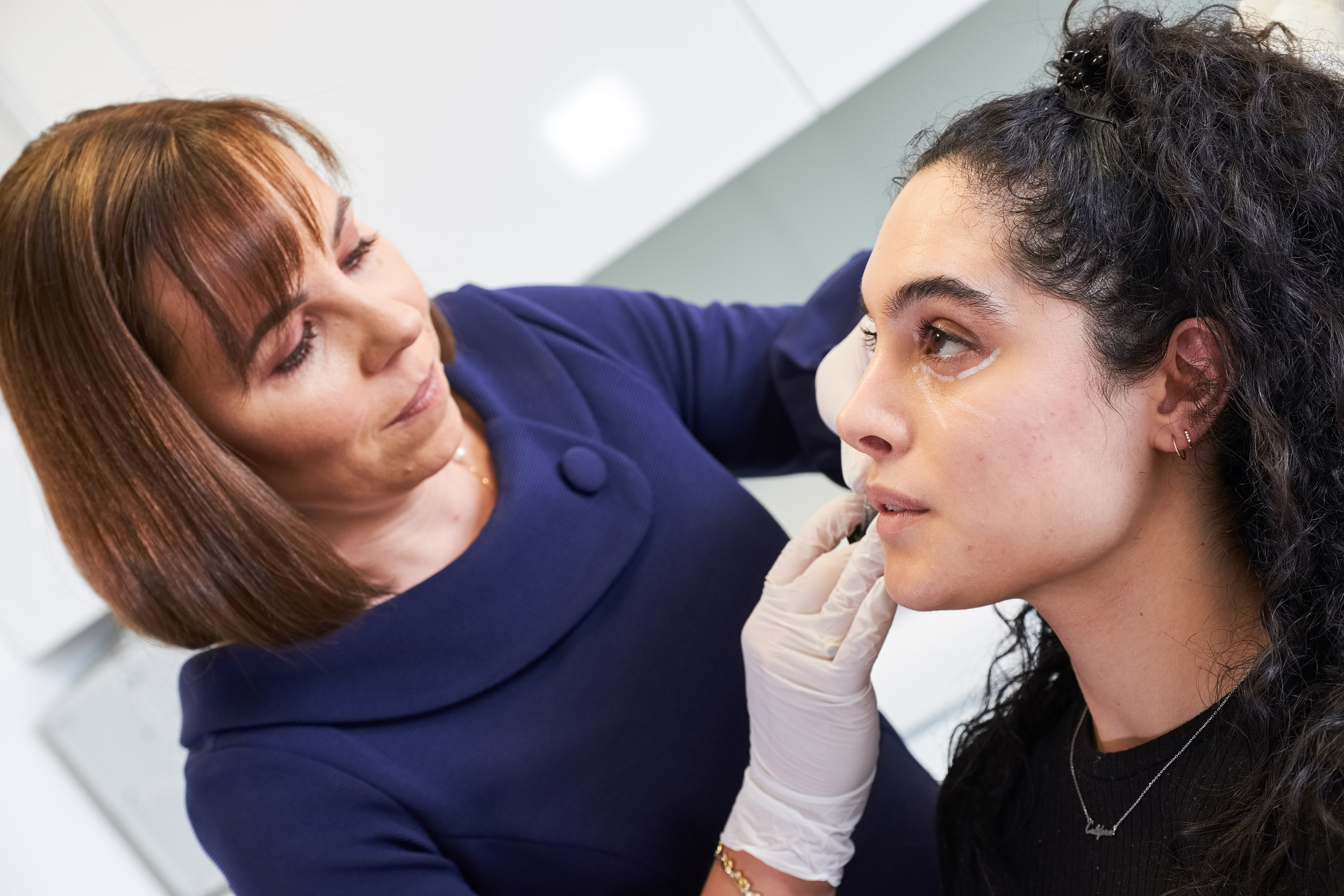 Nose to Mouth Lines DD Clinical