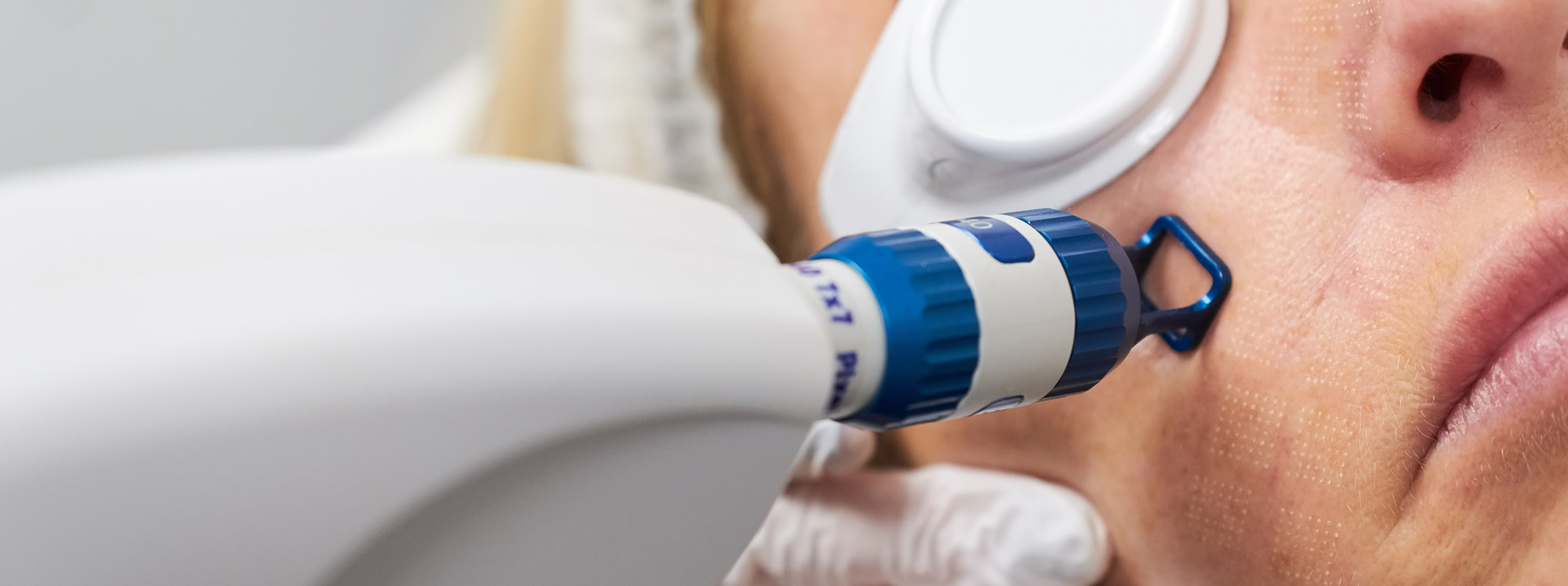 iPixel Laser - DD Clinical